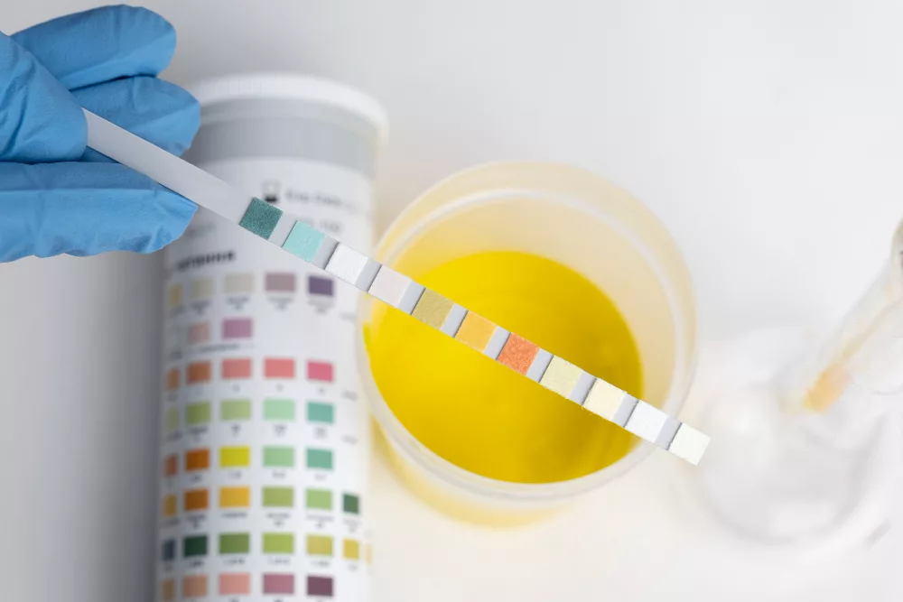 comment éliminer le cbd dans l’urine ?